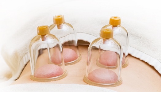 カッピングイメージ