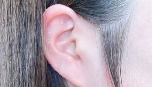 耳ツボストーンイメージ